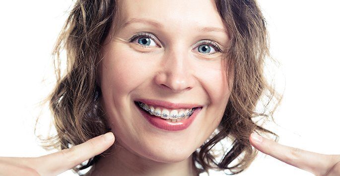 Braces For Adults,  Adult Orthodontics, Invisalign