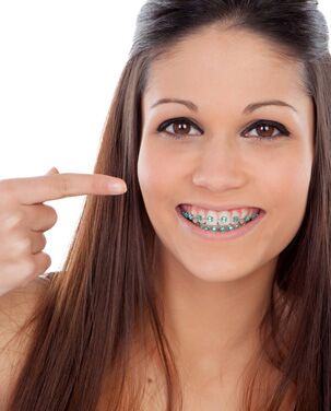 Beautiful Smile, Benefit of Orthodontics